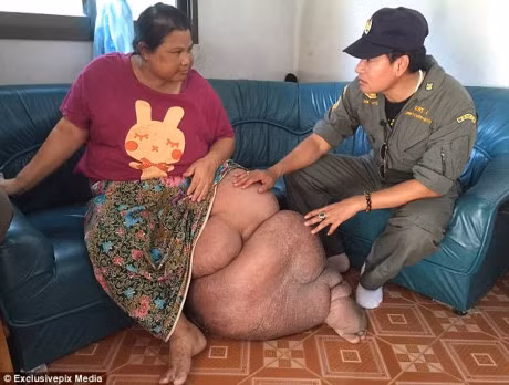 Nguoi phu nu chan voi da duoc dieu tri nho long hao tam cua nguoi la - Anh 3