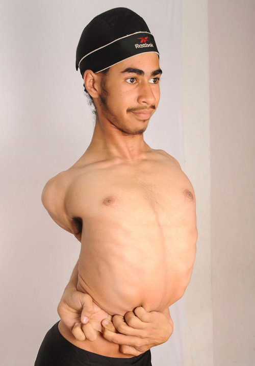 Kinh ngạc màn biểu diễn của người dẻo nhất thế giới ảnh 2 Kinh ngạc với cậu bé có thể vắt chân lên vai - 2