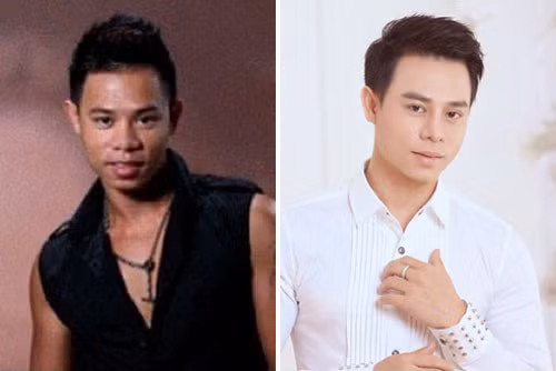 "Ca sĩ xấu nhất Việt Nam" nâng mũi, sửa răng để lột xác