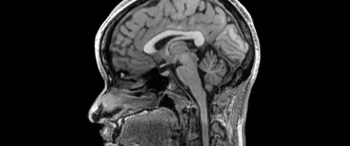 Loài động vật sống không cần não!