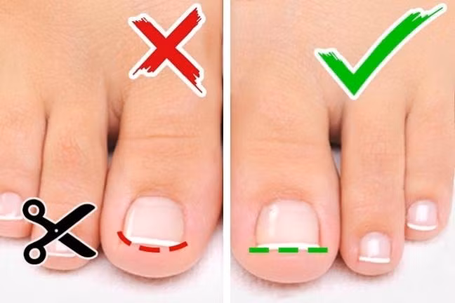 Bo ngay thoi quen cat mong chan quasat neu khong muon hoi han ca doi