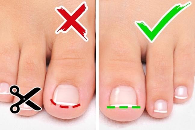 Bỏ ngay thói quen cắt móng chân quását nếu không muốn hối hận cả đời Bo ngay thoi quen cat mong chan quasat neu khong muon hoi han ca doi