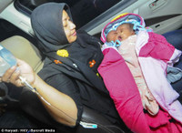 Những bé sơ sinh kỳ lạ khiến y học thế giới kinh ngạc ảnh 4 Những bé sơ sinh kỳ lạ khiến y học thế giới kinh ngạc - 4