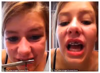 Hạu quả khủng khíep của nieng rang bang day thun tại nhà-Hinh-6