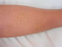 “Tai nạn” kinh hoàng khi dùng kem lột da ảnh 10