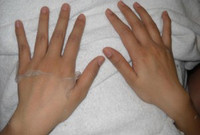 “Tai nạn” kinh hoàng khi dùng kem lột da ảnh 5