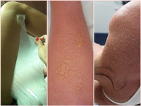 “Tai nạn” kinh hoàng khi dùng kem lột da ảnh 8