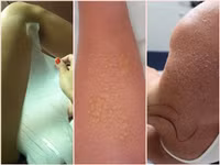 “Tai nạn” kinh hoàng khi dùng kem lột da ảnh 8