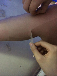 “Tai nạn” kinh hoàng khi dùng kem lột da ảnh 3