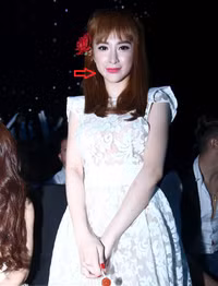 Hành trình lột xác nhờ dao kéo của Angela Phương Trinh