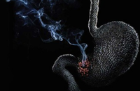 Những ""sát thủ"" giết gan bạn ảnh 18