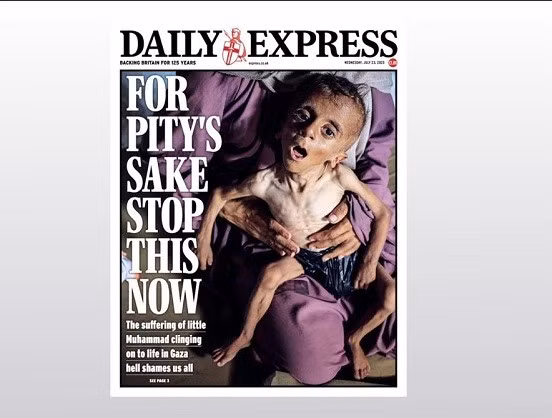 Với những khúc xương lòi ra khỏi lớp da giòn và không có sự cứu trợ nào trước mắt, Muhammad đã sụt từ 9kg xuống còn 6kg do một cuộc khủng hoảng nhân đạo mang tính tận thế. am-anh-3.jpg