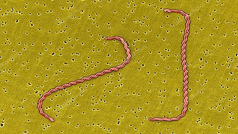 Leptospirosis lây lan qua nước hoặc đất bị ô nhiễm bởi nước tiểu của động vật bị nhiễm bệnh, ví dụ như loài gặm nhấm. Nhiễm trùng có thể xâm nhập vào cơ thể người thông qua vết cắt trên da hoặc qua mắt, mũi, miệng. vi-khuan-2.jpg