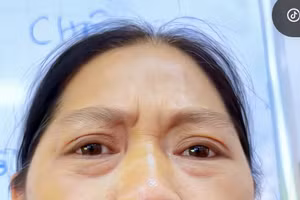 Ảnh: Bà Tuyết giới thiệu về nguồn gốc sản phẩm chân gà rút xương. ảnh: MXH