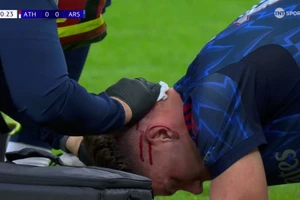 Tân binh đắt giá đổ máu, Arsenal thắng trận ra quân Champions League 