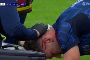 Tân binh đắt giá đổ máu, Arsenal thắng trận ra quân Champions League 