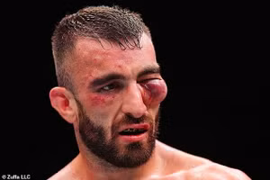 Võ sĩ gốc Việt gây sốc, đối thủ mặt biến dạng, khán giả yêu cầu sa thải trọng tài