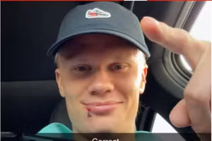 Haaland dính chấn thương hy hữu, khâu 3 mũi