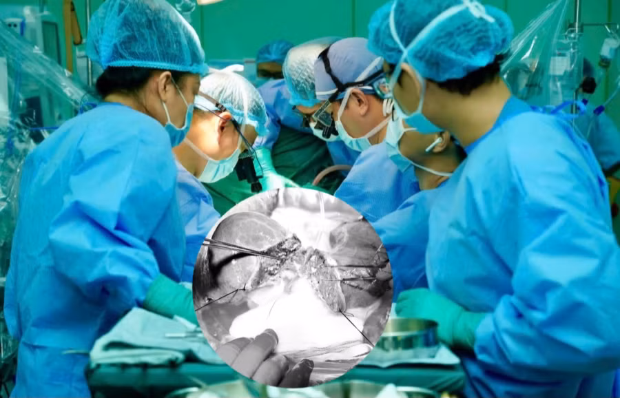 Lá gan của người đàn ông 44 tuổi cắt đôi cứu sống 2 cuộc đời. 