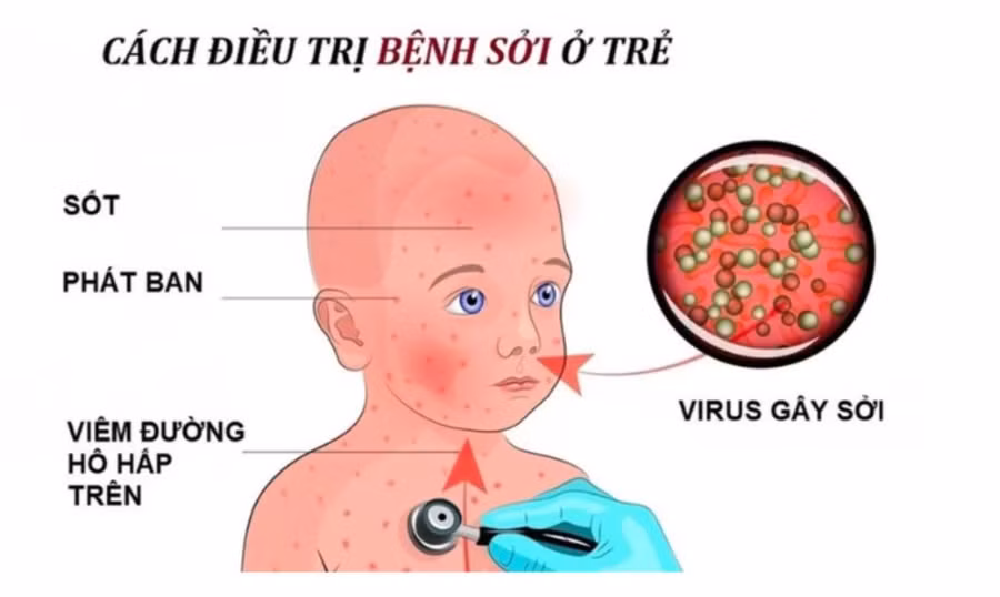 bb74a49eb88a1cd4459b (1).jpg