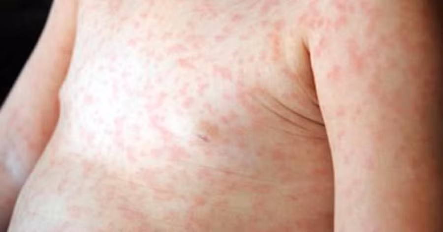 e2c7fe29e23d46631f2c (1).jpg