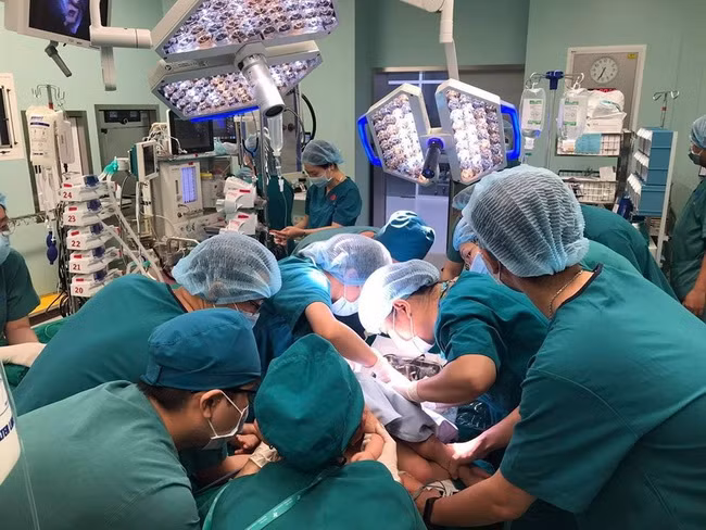 Cuộc đại phẫu tách dính cặp song sinh hiếm gặp dự định kéo dài 12 tiếng