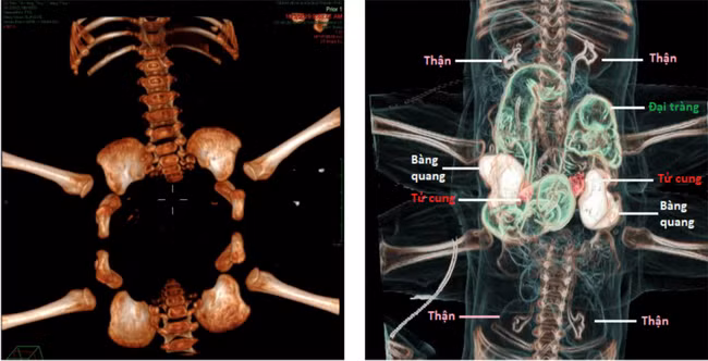 Cuộc đại phẫu tách dính cặp song sinh hiếm gặp dự định kéo dài 12 tiếng ảnh 3