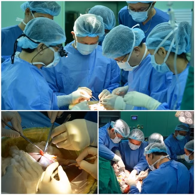 Ghép gan xuyên đêm cứu sống bệnh nhân xơ gan tại TP.HCM ảnh 6