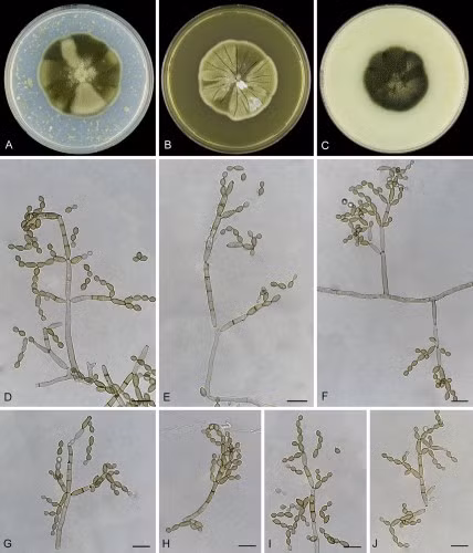 Nấm chắn phóng xạ ảnh 1