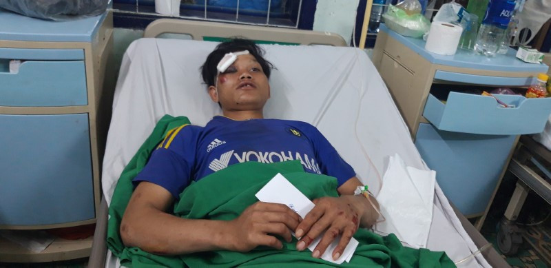 A Thiêng được cấp cứu tại bệnh viện với vết thương ở khắp cơ thể.