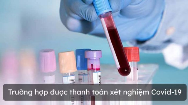 Hướng dẫn thanh toán chi phí xét nghiệm COVID-19