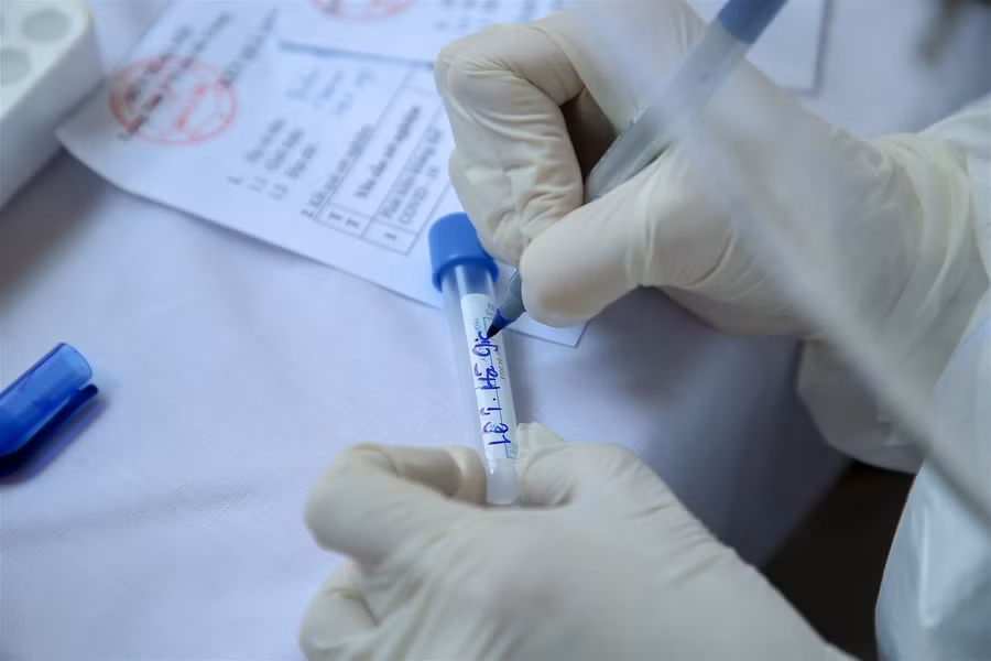 Hà Nội: Tiến hành test nhanh Covid-19 cho những người trở về từ Đà Nẵng ảnh 14