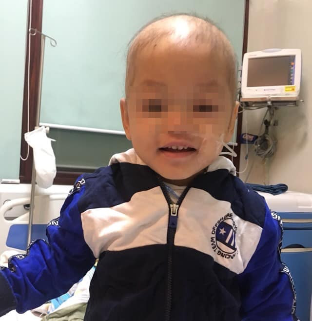 Lần đầu tiên Việt Nam ghép tủy thành công cho bệnh nhi mắc Wiskott-Aldrich hiếm gặp ảnh 1 Lần đầu tiên Việt Nam ghép tủy thành công cho bệnh nhi mắc Wiskott-Aldrich hiếm gặp ảnh 1