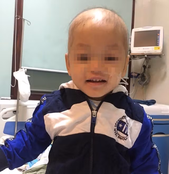 Lần đầu tiên Việt Nam ghép tủy thành công cho bệnh nhi mắc Wiskott-Aldrich hiếm gặp ảnh 1