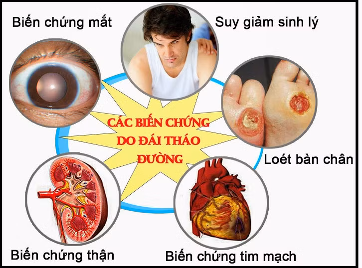 Người bị đái tháo đường cảnh giác với những biến chứng ảnh 1