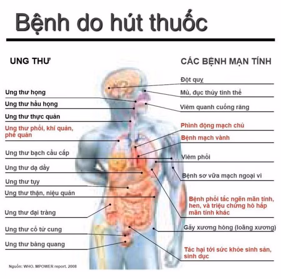 Hút thuốc lá, nguy cơ mắc ung thư phổi cao gấp hàng chục lần ảnh 1