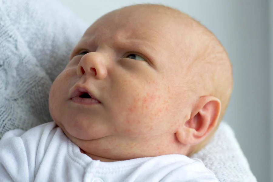 Con dâu sinh con tóc vàng hoe, mẹ chồng lén đi giám định ADN rồi hối hận