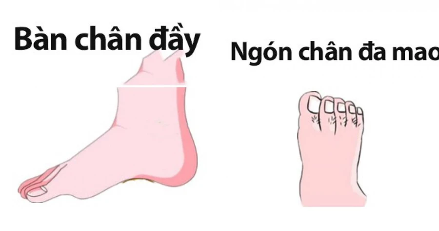 Tướng bàn chân phụ nữ cả đời hưởng trọn vinh hoa phú quý