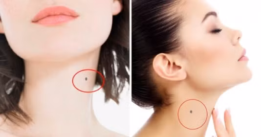 Vị trí nốt ruồi tài lộc trên cổ người phụ nữ cả đời "ngồi mát ăn bát vàng"