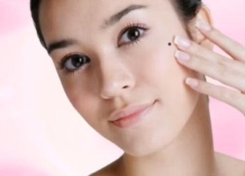 5 vị trí nốt ruồi phú quý trên khuôn mặt phụ nữ