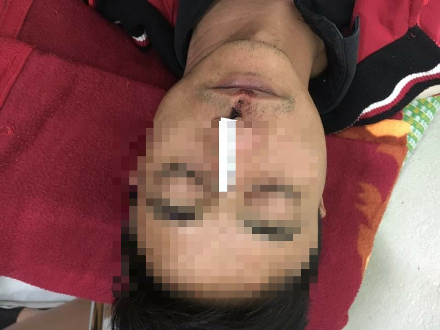 Thái Bình: Khởi tố, bắt tạm giam nhân viên của nhà xe Phiệt Học ảnh 1 Thái Bình: Khởi tố, bắt tạm giam nhân viên của nhà xe Phiệt Học ảnh 1