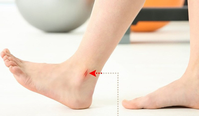 8 dấu hiệu ở chân cảnh báo bạn có thể mắc bệnh nguy hiểm ảnh 6 8 dấu hiệu ở chân cảnh báo bạn có thể mắc bệnh nguy hiểm ảnh 6