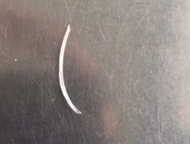 Cách xử lý hiệu quả ngay khi bị hóc xương cá ảnh 12