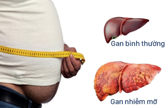 Hai căn bệnh không chữa sớm rất dễ chuyển thành ung thư