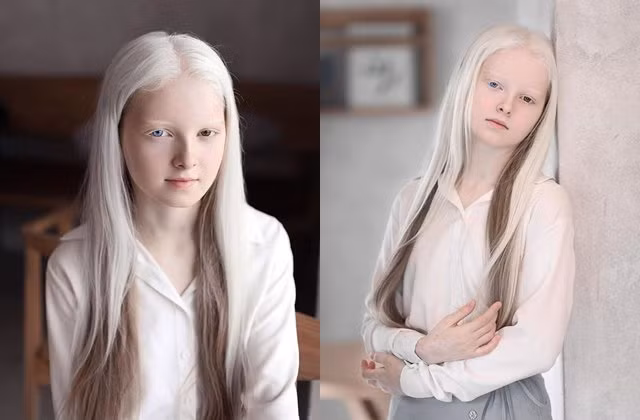  Bé gái xinh đẹp có đôi mắt và mái tóc 2 màu độc nhất vô nhị 