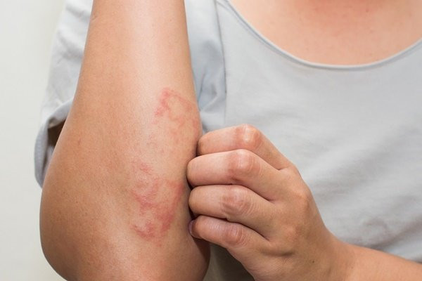 Bác sĩ bệnh viện K cảnh báo dấu hiệu nhận biết sớm bệnh ung thư máu Bác sĩ bệnh viện K cảnh báo dấu hiệu nhận biết sớm bệnh ung thư máu