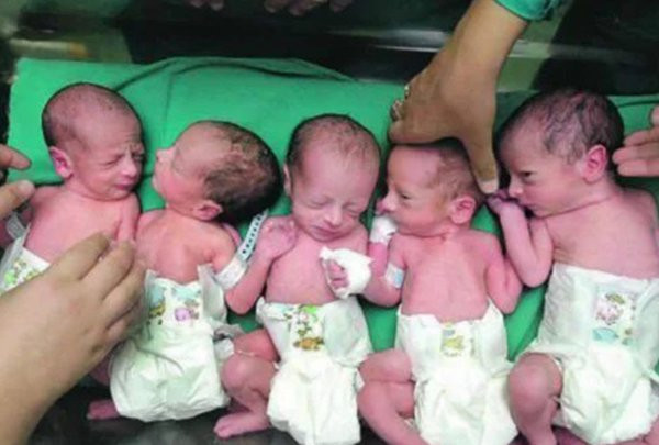 Tưởng bầu đôi, mẹ bàng hoàn nghe bác sĩ đếm đi đếm lại số thai trong bụng ảnh 6 Tưởng bầu đôi, mẹ bàng hoàn nghe bác sĩ đếm đi đếm lại số thai trong bụng ảnh 6