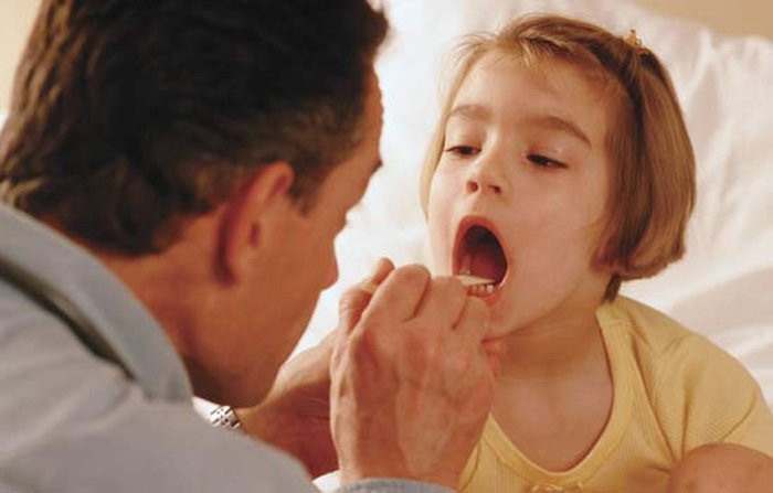 Bị bệnh bạch hầu nên và không nên ăn gì?