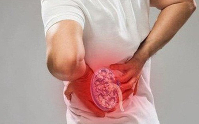 Bác sĩ mách 8 nguyên tắc vàng bảo vệ thận