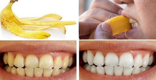 Bí quyết giúp răng trắng tinh từ nguyên liệu có sẵn trong bếp ảnh 2 Bí quyết giúp răng trắng tinh từ nguyên liệu có sẵn trong bếp ảnh 2